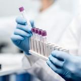 Ocena predyspozycji do endometriozy - test EndomKIT