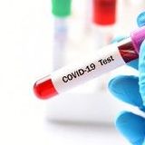 SARS-CoV-2 total antibodies quantitative (against RBD domain)