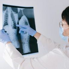 Spine X-ray (Scoliosis) – AP and Lateral Views