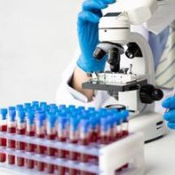 Syphilis serology (VDRL)