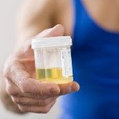 General urine analysis