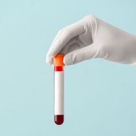 HIV Pre-exposure Prophylaxis (PrEP) Testing Package (for the qualification visit)