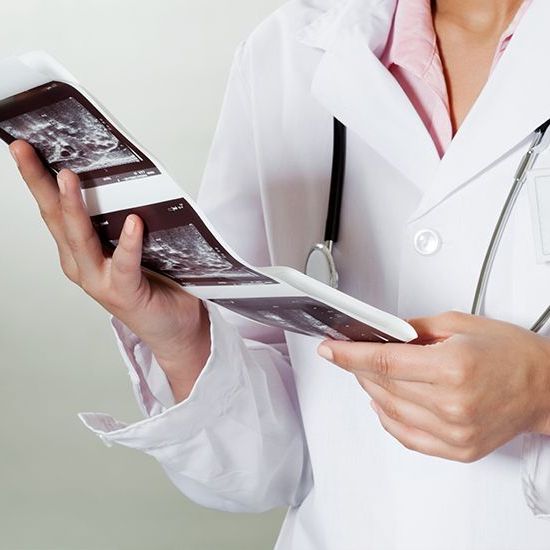 Ultrasound of the arteries of the upper limbs