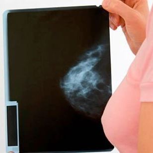 Breast ultrasound elastography