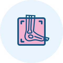 Thigh X-ray AP + lateral - children