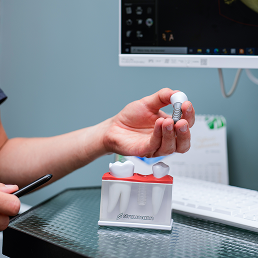 Implant consultation