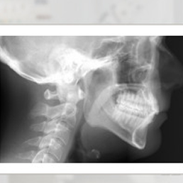 Cephalometric X-ray