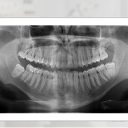 Panthomographic x-ray