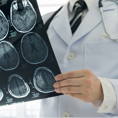 Umów konsultację profesorską z neurochirurgii